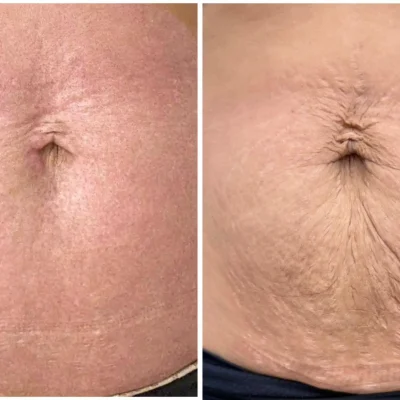 WhatsApp Image 2026-01-19 at 14.17.42