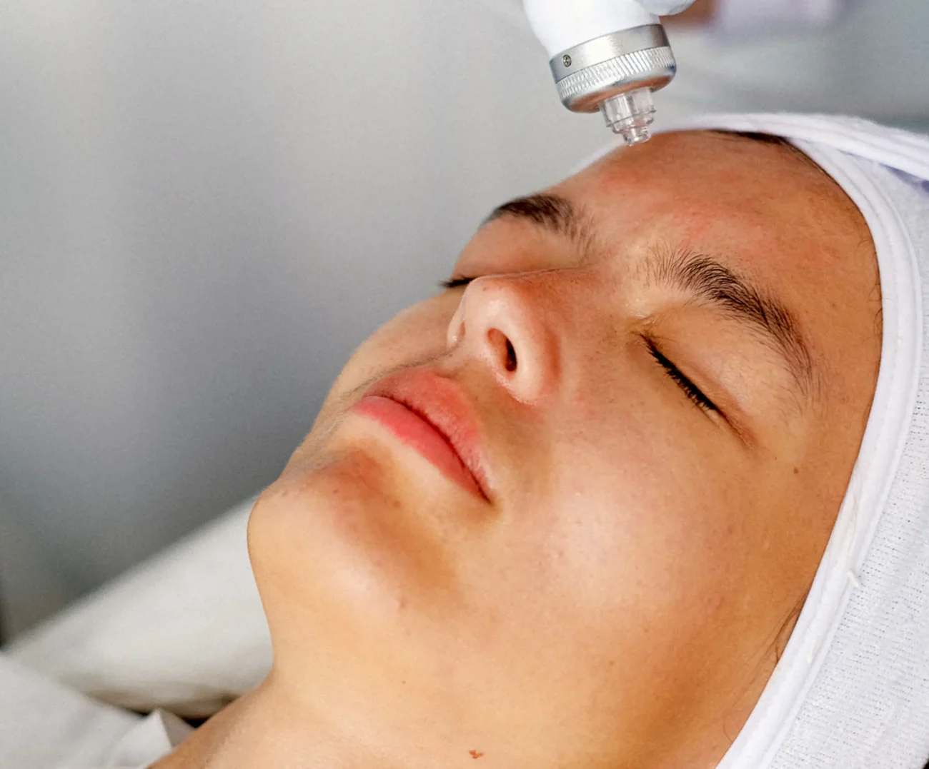 מזותרפיה + RF